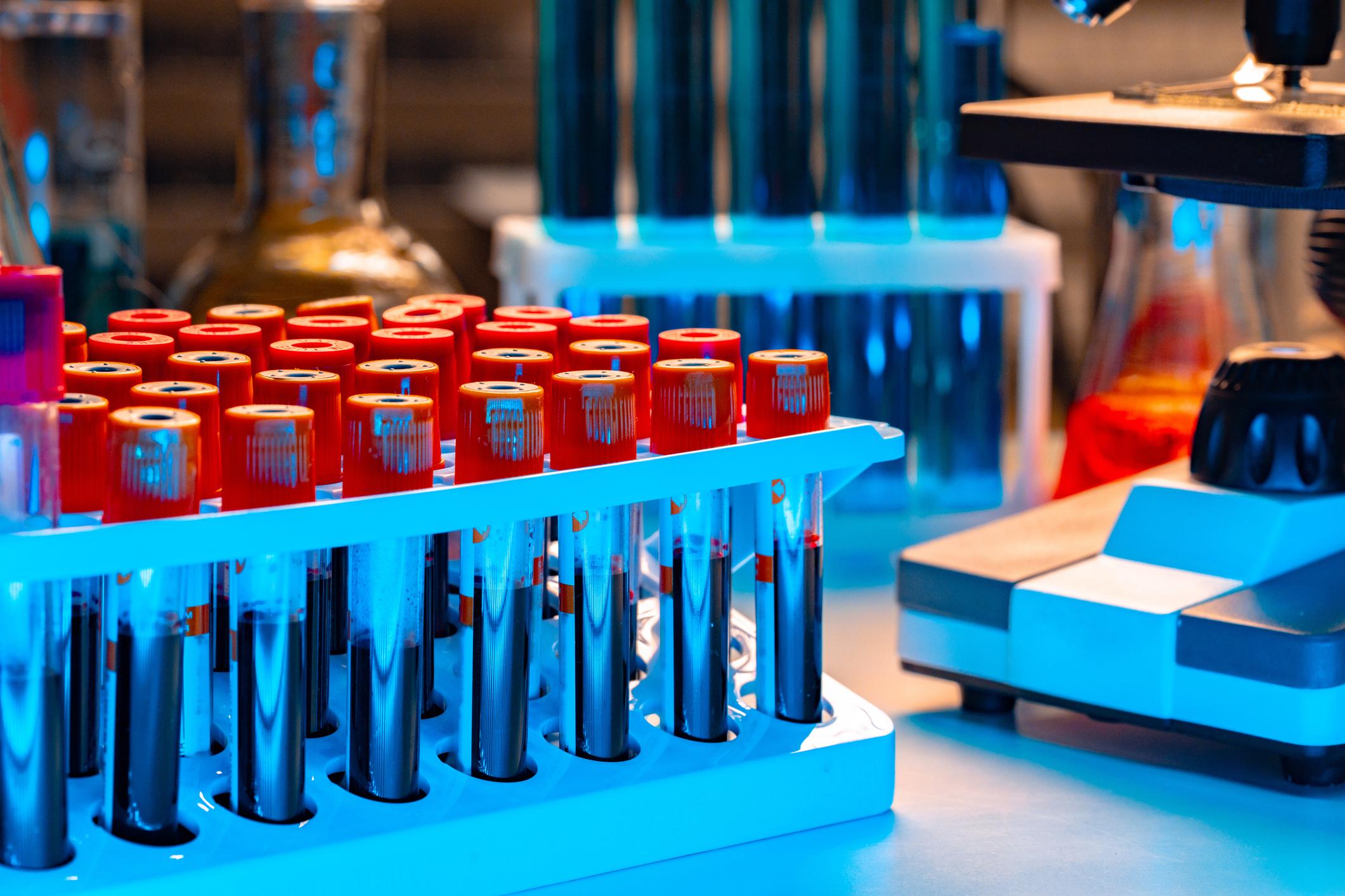 Automated analyser processing blood samples